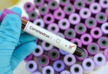 Stožer CZ BPŽ: 14 novih pozitivnih osoba u županiji