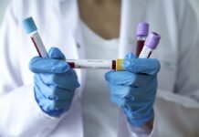 U Hrvatskoj 357 novih slučajeva, preminule tri osobe