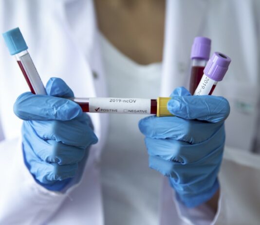 48 novooboljelih osoba od covida 19 u protekla 24-sata