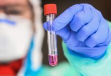 Hrvatski epidemiolozi imaju ideju: Kontakte zaraženih pratit će nezaposleni