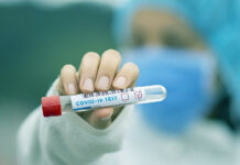 U Brodsko posavskoj županiji 45 novih slučaja zaraze od COVID-19