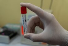 STOŽER CZ BPŽ: Evidentirana su 33 nova pozitivna nalaza osoba zaraženih virusom SARS-CoV-2